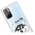 IMD Xiaomi Redmi Note 11 Pro/Note 11 Pro+ TPU Case - Smile